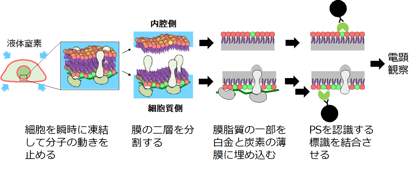 遺伝性脊髄小脳失調症