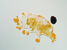 Pseudechiniscus shintai