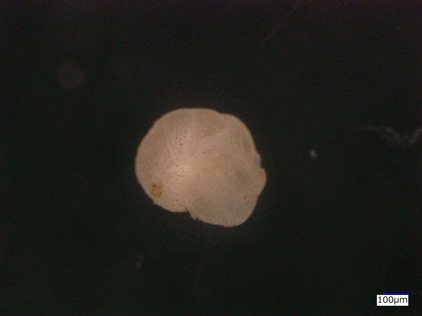 シビシデス・ロバツルス（殻の表側（旋回面））