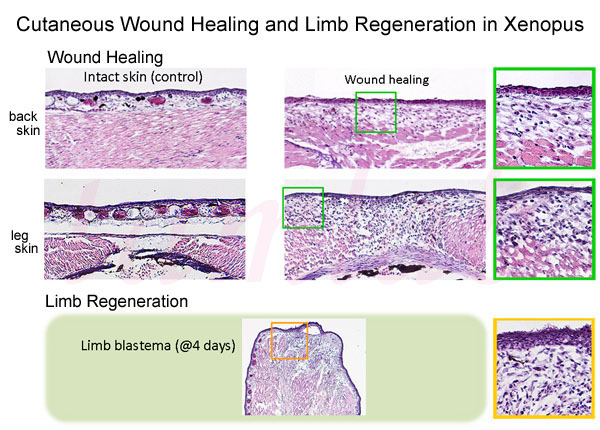 Wound Healing and Limb Regeneration